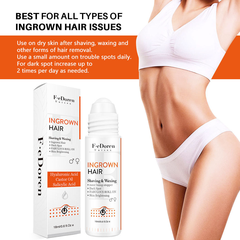 Conveniently Apply Roller Hair In-growth For Men