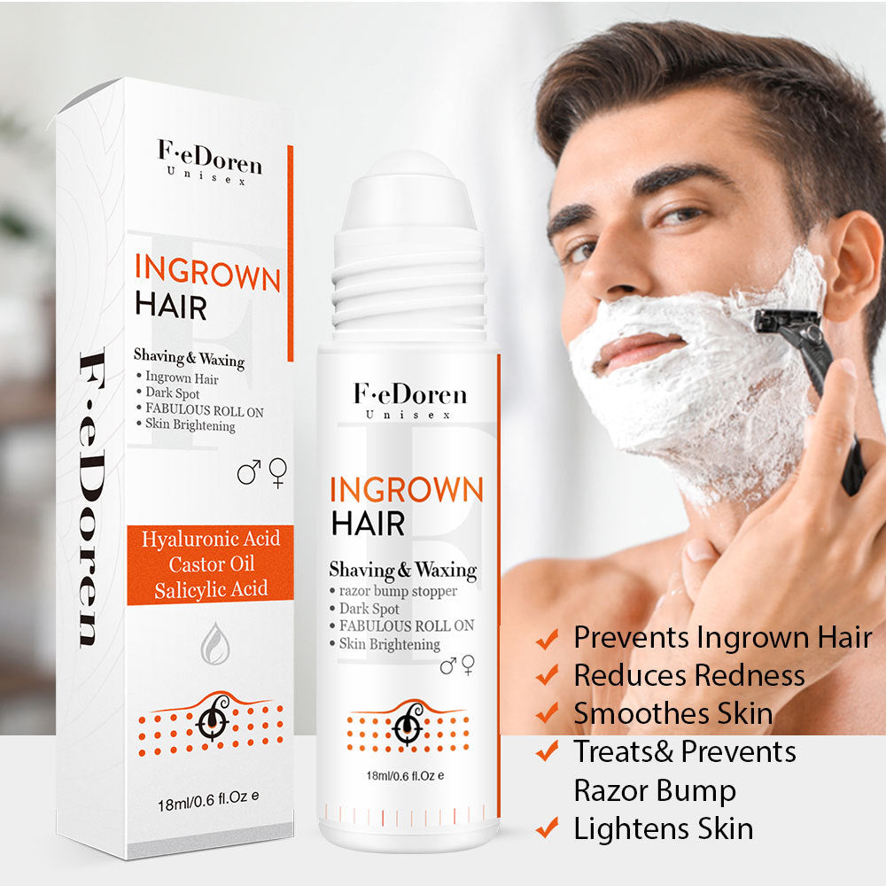 Conveniently Apply Roller Hair In-growth For Men